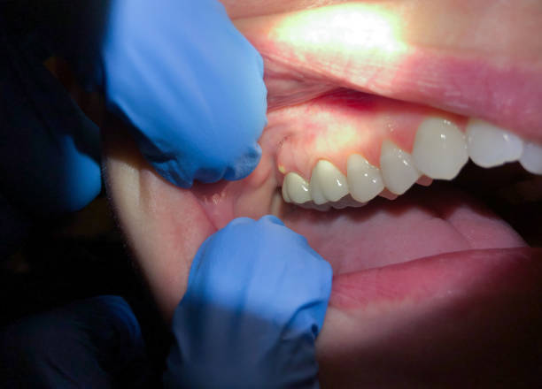 Best Mobile Emergency Dentist in Lexington, OH